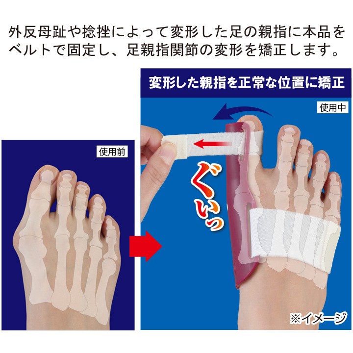 足 サポーター 外反母趾矯正 プロテクター 寝ながら 外反母趾 矯正 グッズ 就寝 時 用 外反母趾対策