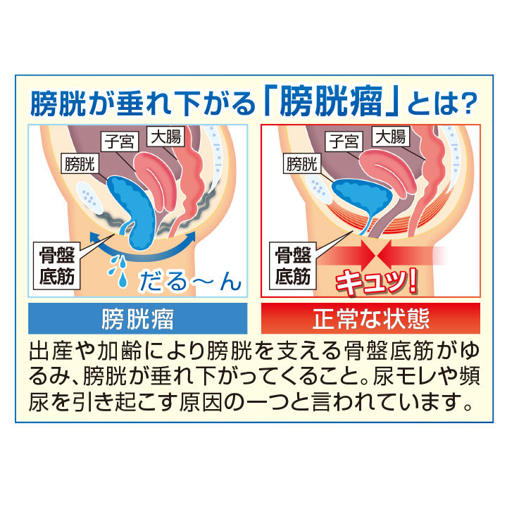 モレナレディ― 失禁対策 漏れ対策 レディース 婦人 骨盤底筋ベルト