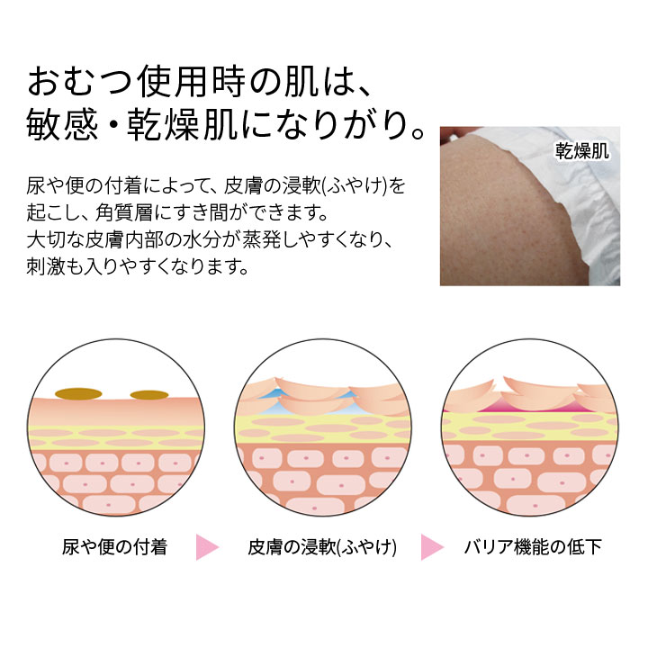 失禁対策 介護 便利 からだ拭き ウェットタオル ふわふわ やわらかい 流せる 乾燥肌 敏感肌