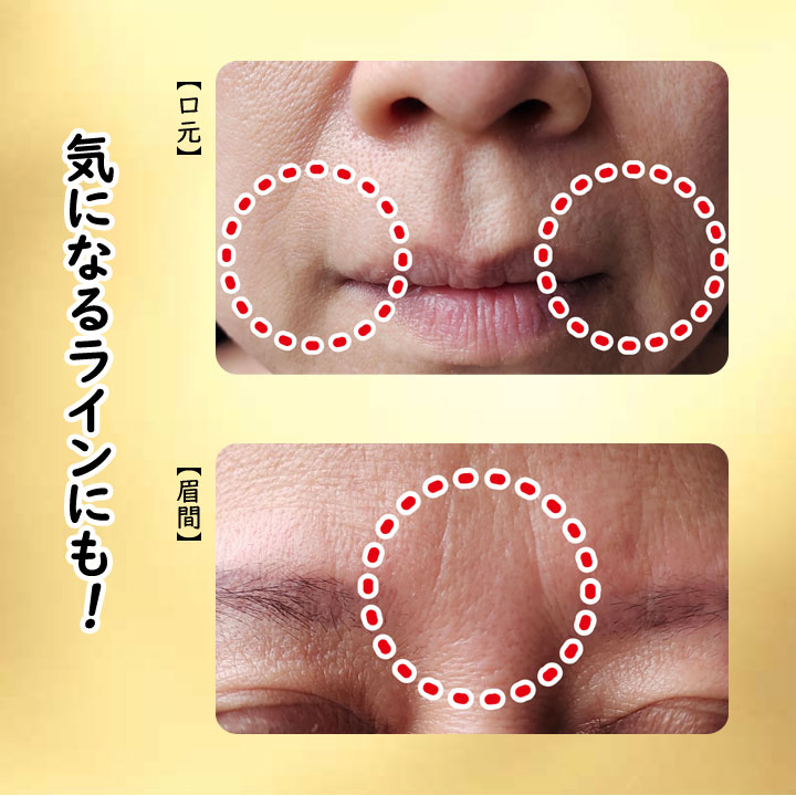 クリーム 美容成分 目元 口もと 眉間 フェイス 顔 ケア 直塗り ローラー 簡単 手軽