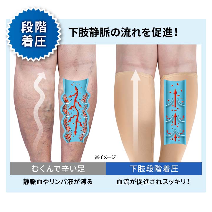 一般医療用サポーター ふくらはぎ サポーター 着圧 むくみ 下肢静脈瘤 リンパの流れ 血行促進