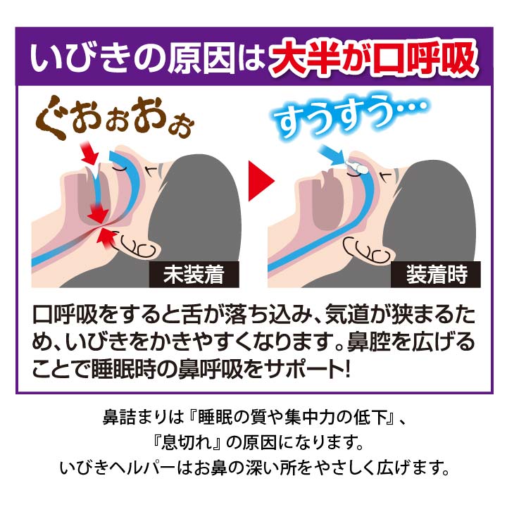 いびき ノーズピン 鼻腔拡張器具 鼻呼吸改善 イビキ対策キャップ 男女兼用