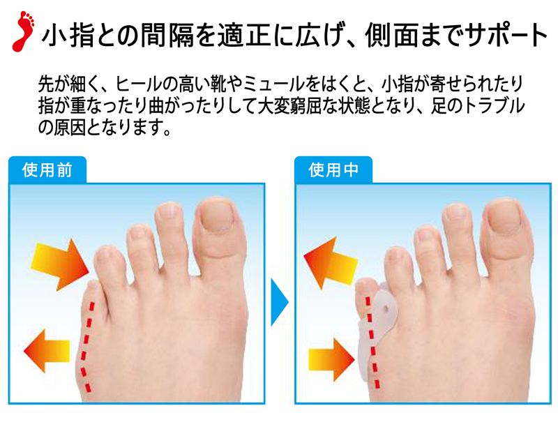【メール便送料無料】 ないはんしょうし 足 小指 ゲルパッド 2個入 ぷにぷに 柔らか 内反小趾 サポーター 器具 足指 パッド 開く 広げる グッズ 保護 328537