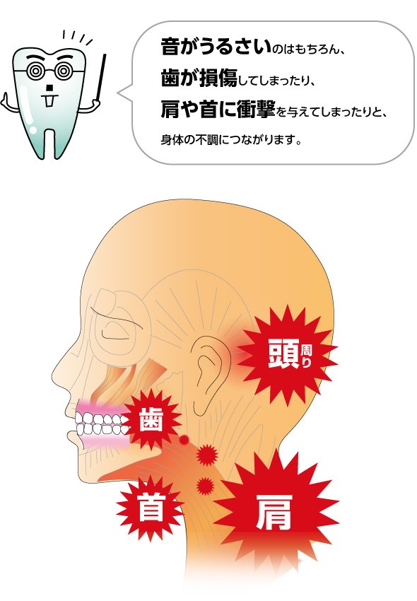 歯ぎしりピタリ 歯ぎしり防止 マウスピース 日本製 食いしばり 防止 グッズ 奥歯 型取り不要 歯 ケース付 歯ぎしりピタリ ソフト 柔らかい 市販 睡眠時 噛み締め防止 334046