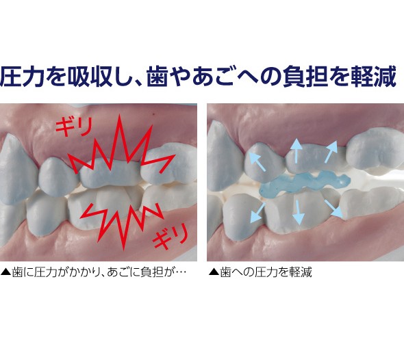 歯ぎしりピタリ 歯ぎしり防止 マウスピース 日本製 食いしばり 防止 グッズ 奥歯 型取り不要 歯 ケース付 歯ぎしりピタリ ソフト 柔らかい 市販 睡眠時 噛み締め防止 334046