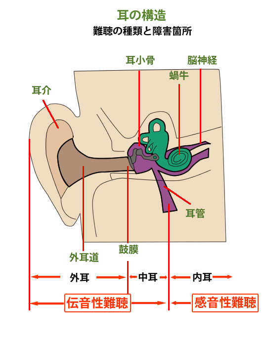 難聴について 補聴器専門店 快聴生活 通販 Yahoo ショッピング