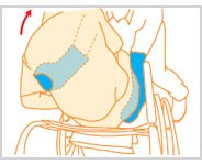 車いすへの移乗１