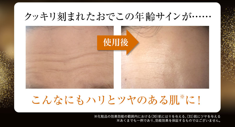 オデコディープパッチ - www.husnususlu.com