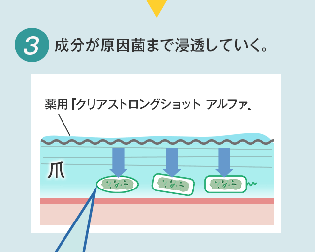 クリアストロングショット アルファ 爪 の中まで浸透・殺菌 薬用 ジェル 正規販売店 ホテルビーナス :SH:北の快適工房 - 通販 -  Yahoo!ショッピング