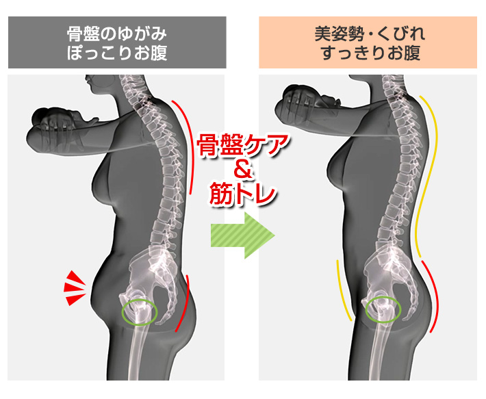 ぽっこりお腹 すっきりお腹