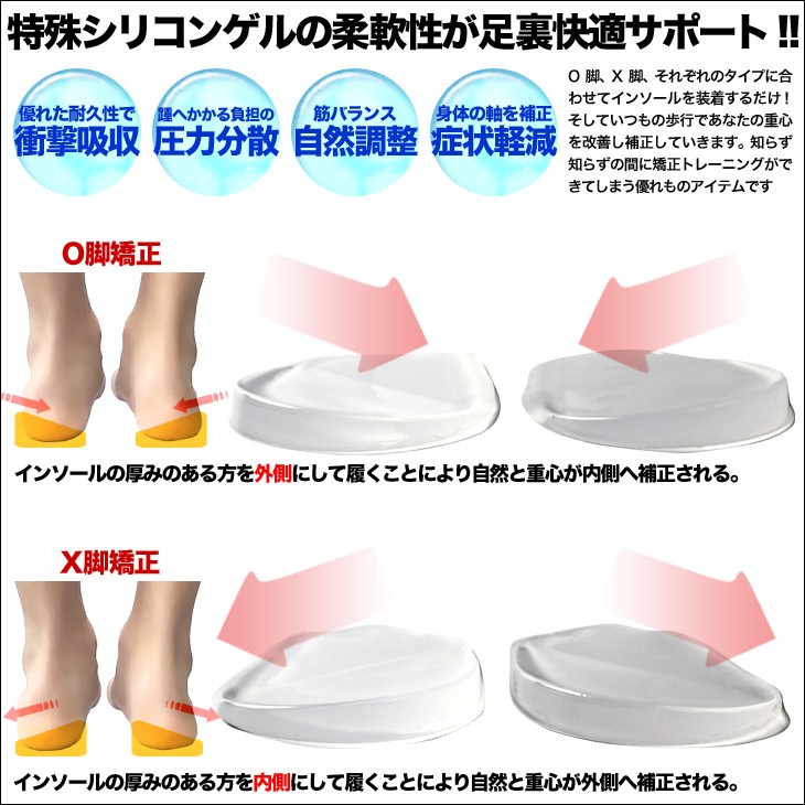 O脚矯正 X脚矯正 O脚 X脚が気になる方に 矯正インソール 2セット入 いつもの靴に入れるだけ コッソリ美しい美脚ラインに 2セット入 O 30 シークレット靴専 通販 Yahoo ショッピング