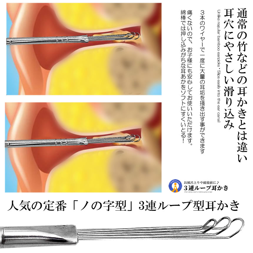 5個セット 3連 ループ ワイヤー 耳かき ごっそり取れる ソフト 乾燥 耳垢 掻き出す 水洗い イヤー クリーナー ピック 耳掃除 穴 爽快 ステンレス 3ROOPMI｜kasimaw｜06