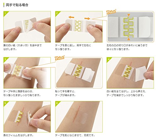 Amazon.co.jp: skinix(スキニックス) アトレスケア 傷あとケア
