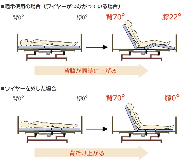 ワイヤーの着脱