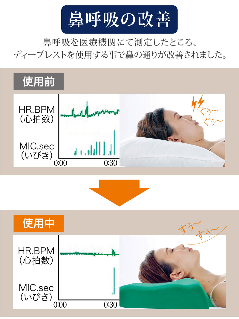 いびきトルネル　新品未使用　専用枕カバー付き　イビキ防止枕　無呼吸症候群　解消 Deep Rest ディープレスト 枕カバー付き 枕 いびき防止 無呼吸