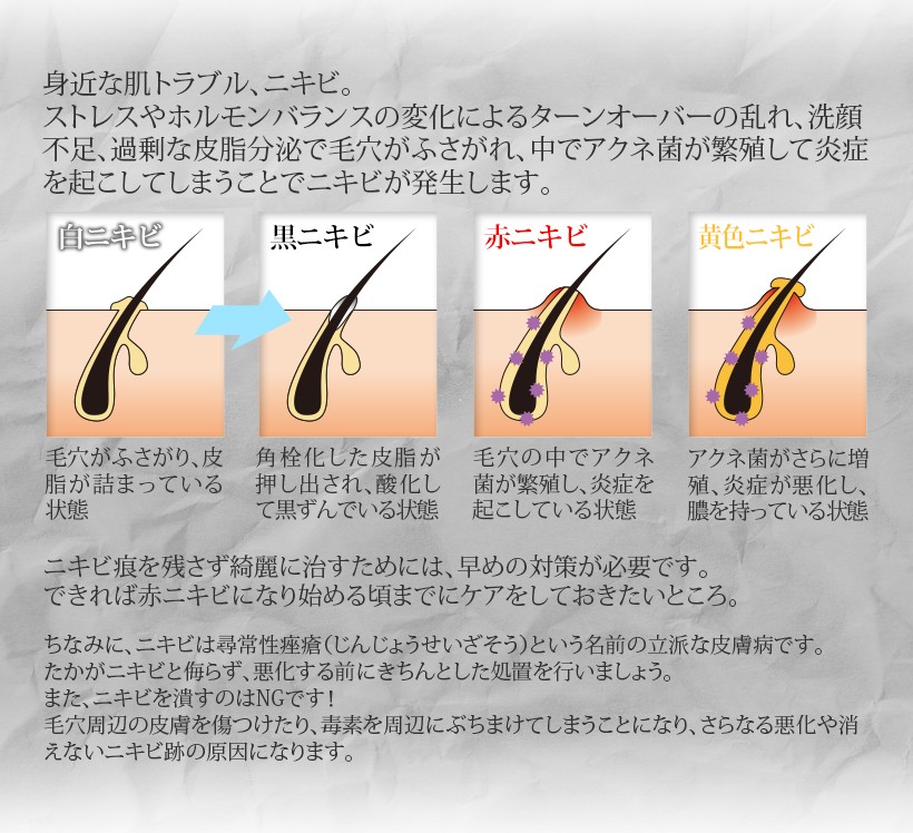 美顔器 ニキビケア アクネケア 光エステ 振動 温熱 美ルル アクネ アクネ菌 光エステ 青色LED 美肌 美顔機  :beluluforacne:ヤンコム 通販 