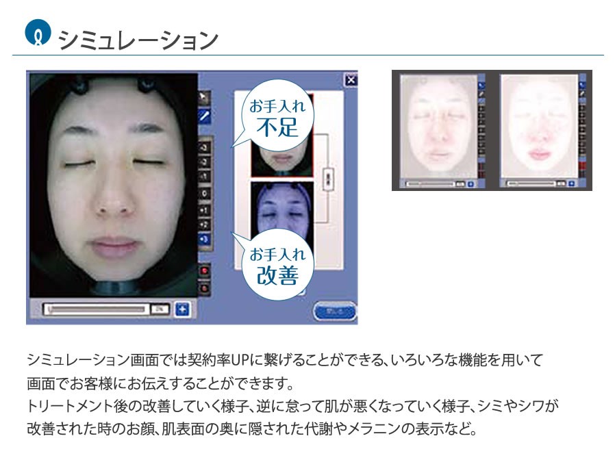 A-ONE Lite/エーワンライト【肌解析】【カウンセリング A-ONE Lite/エーワンライト【肌解析】【カウンセリング