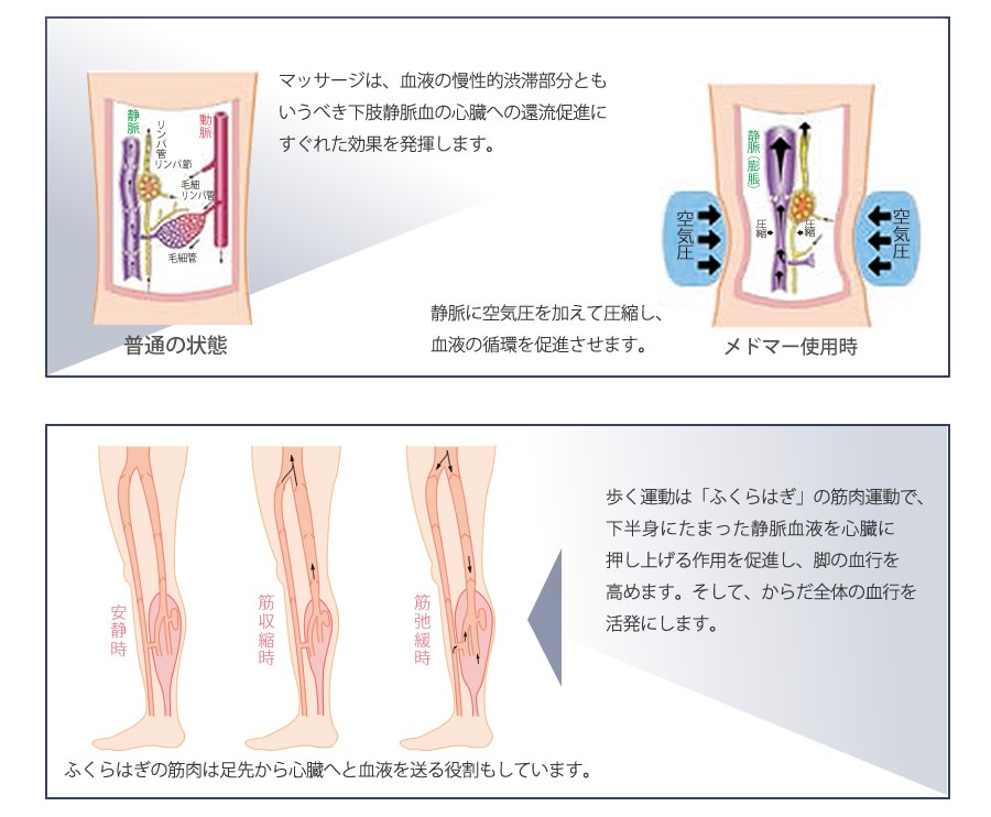 メドマー使用時