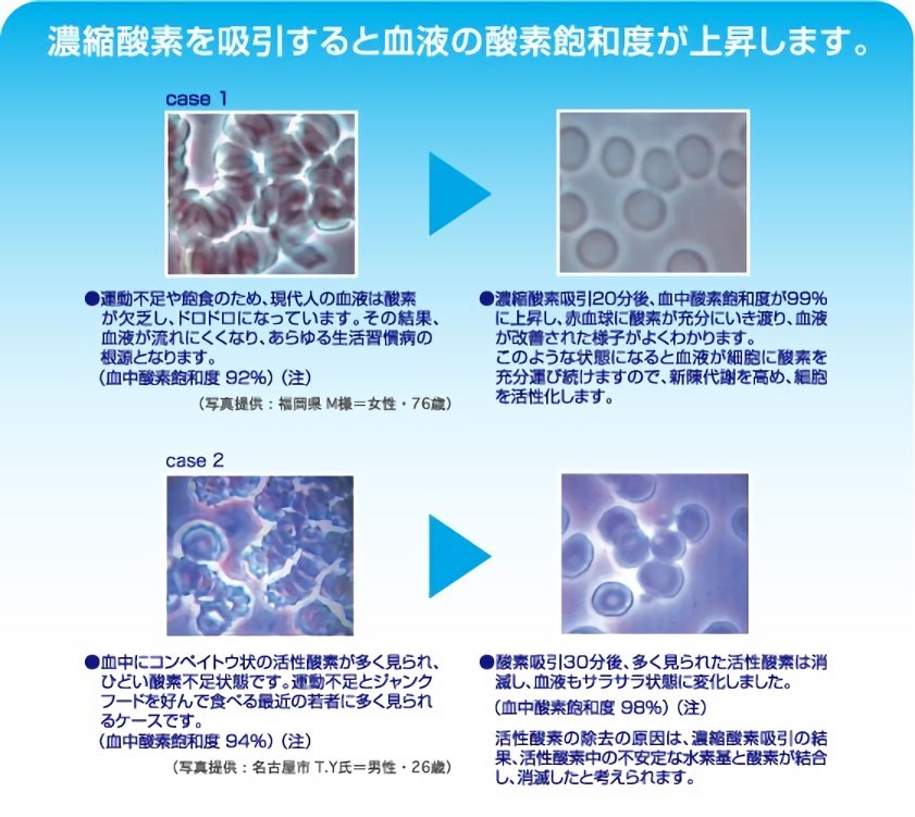 ≪酸素濃度は約90％〜 酸素濃縮器 AJ300 5L/分≫酸素発生器/小型酸素吸入器/酸素生成器 【送料無料】 : a0205 : 神戸メディケア  KMC卸販売Yahoo!店 - 通販 - Yahoo!ショッピング