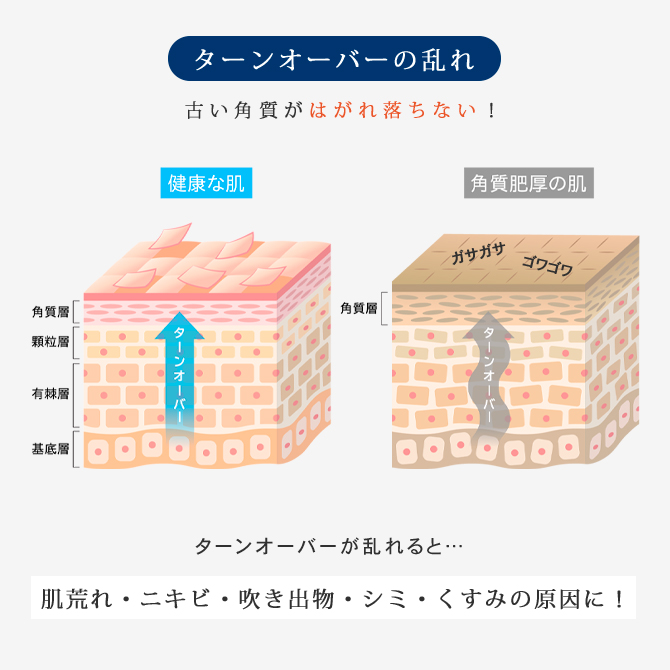 スキンクリアジェル つめかえセット
