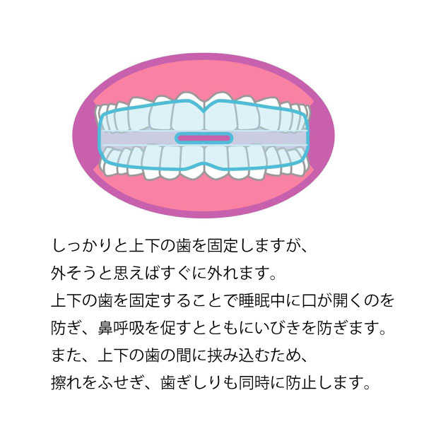 トプラン いびきマウスガード 本格派マウスピー...の詳細画像4