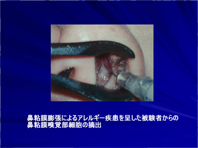 骨盤ベルト コシラック・スリープ（旧名称：コシラック・スポーツ