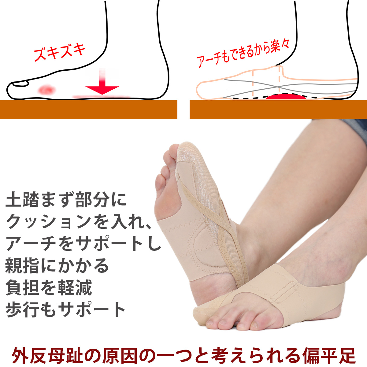 送料無料 外反母趾 矯正サポーター 靴も履けるんデスEX くつもはけるん