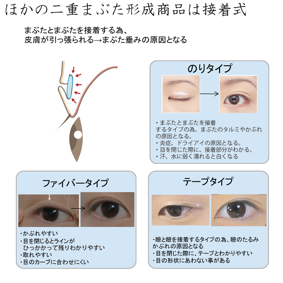 【在庫限り】ローヤルアイムエクストラII‐二重まぶた形成商品