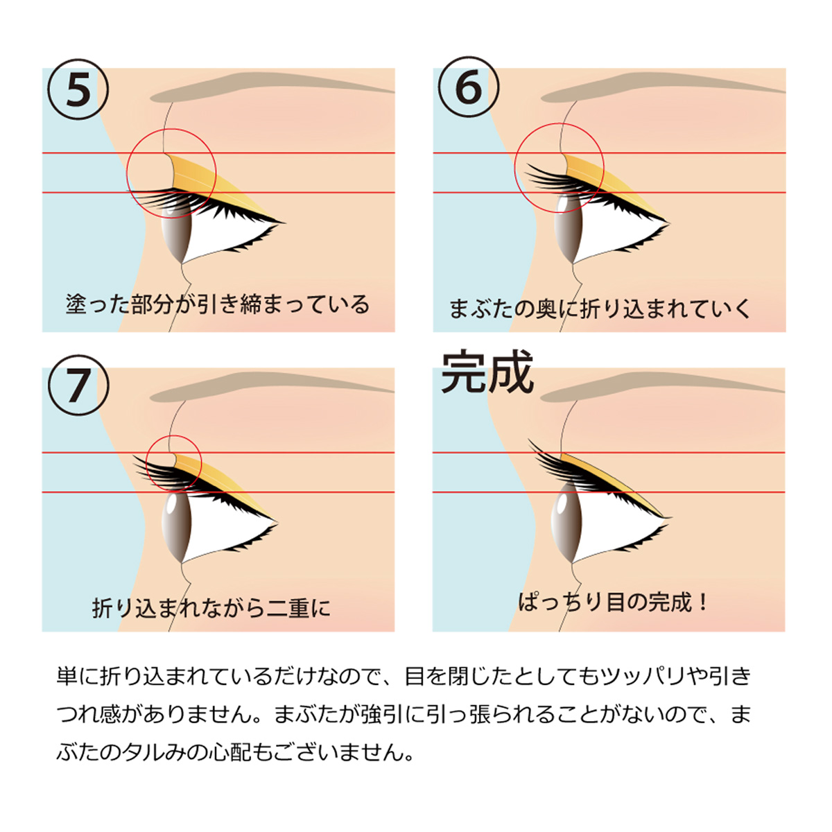 在庫限り】ローヤルアイムエクストラII‐二重まぶた形成商品 9ml 