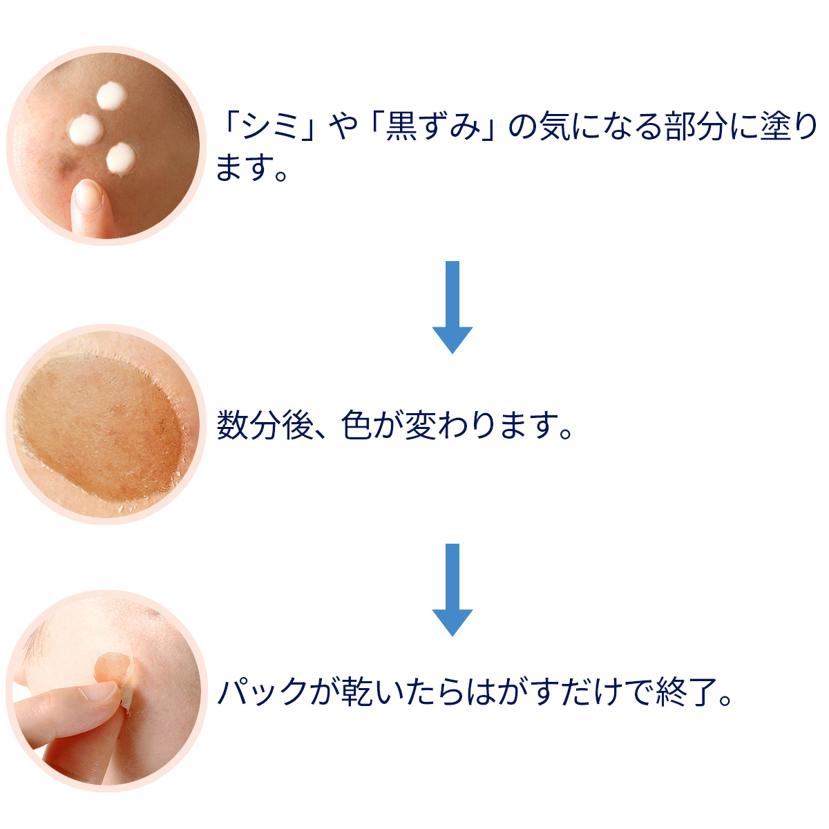 【新品未使用】 最新型 シミ スポットケア マシン kurazo_spotclearoffp01