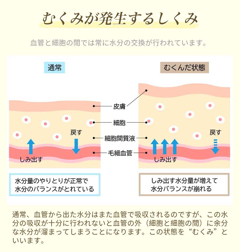 着圧ソックス 弾性ストッキング 膝上 強め メディキュット 静脈瘤 むくみ解消 リンパケア 血行促進 出産/手術後の血栓予防 太もも  立ち仕事/エコノミー症候群