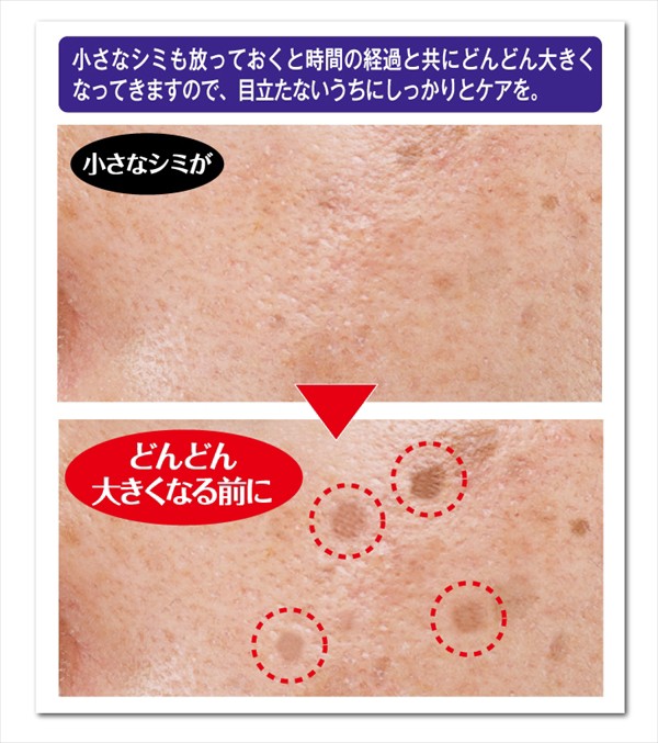 シミ取り パック そばかす 黒ずみ 美白 ナイトクリーム パック メラニン対策 薬用 シミダスパック 30g 医薬部外品 送料無料 N Ns R001 Lash Premium 通販 Yahoo ショッピング