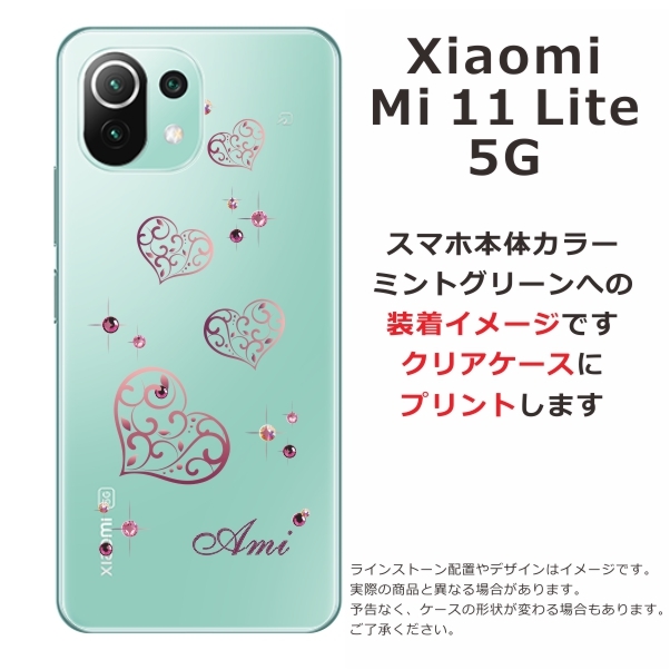 Mi Xiaomi 11 Lite 5G ケース シャオミ M11ライト カバー ライン