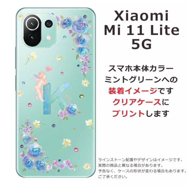 Mi Xiaomi 11 Lite 5G ケース シャオミ M11ライト カバー ライン