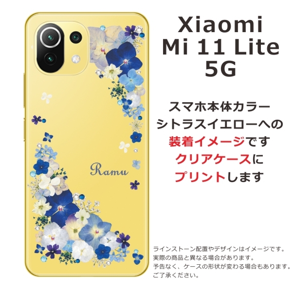 Xiaomi Mi 11 Lite 5G ケース シャオミ M11ライト 5G カバー ライン