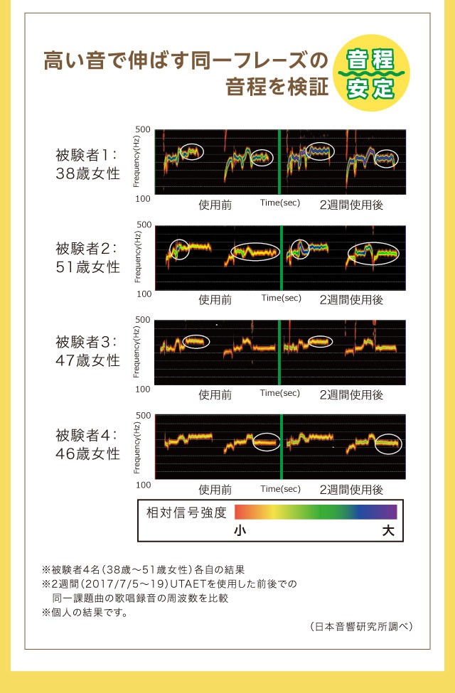 UTAET ウタエット ボイストレーニング 器具 ボイトレ グッズ ストレス発散 家 自宅 カラオケ 歌 練習 グッドデザイン賞 巣ごもりグッズ