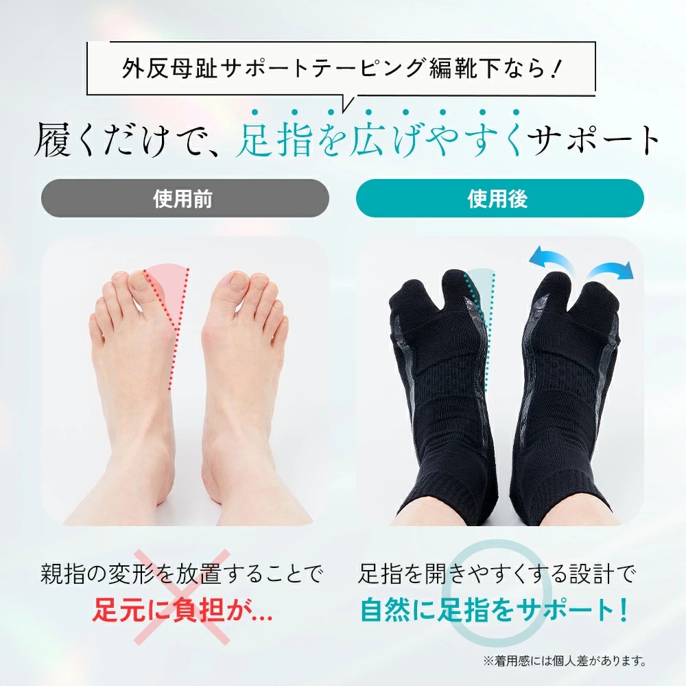 外反母趾サポートテーピング編靴下