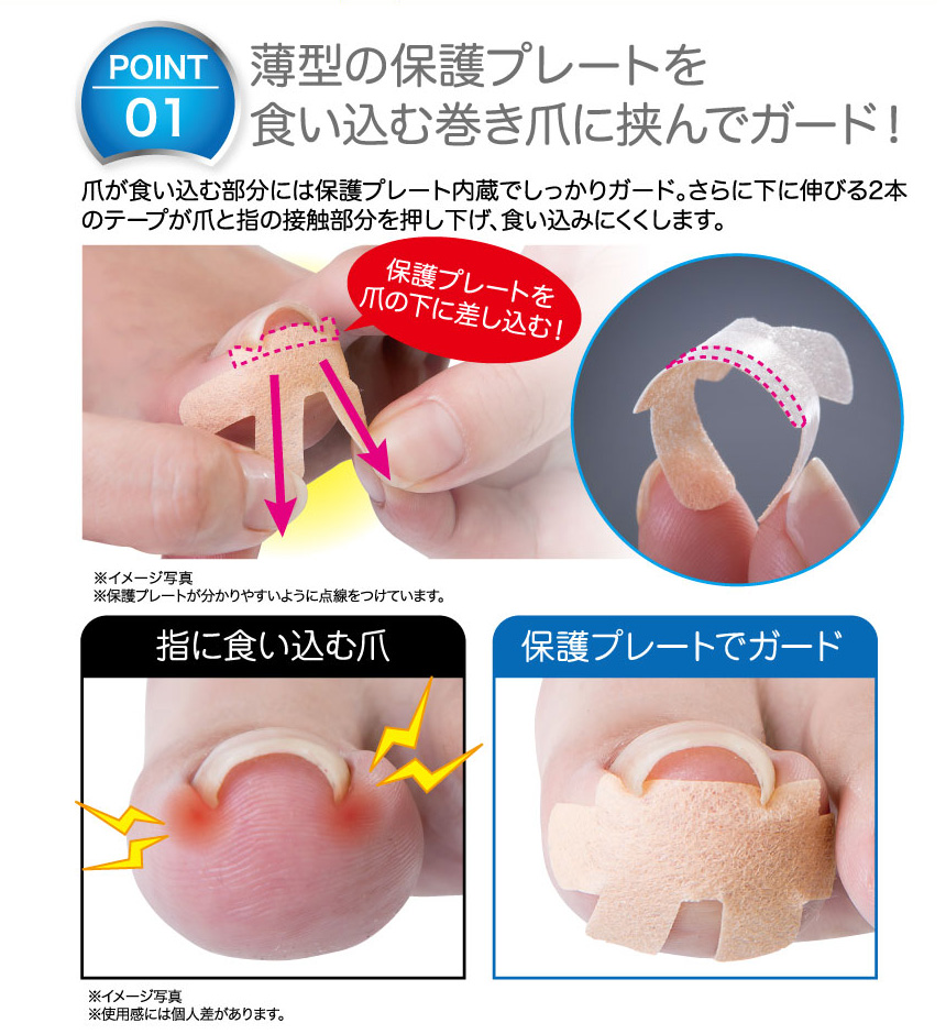 ドクタープロ 簡単 貼るだけ 巻き爪 食い込みガードテープ 巻きづめ 矯正 保護 テープ 巻き爪の治し方 巻爪 ケア テーピング シール フットケア  巻き爪対策