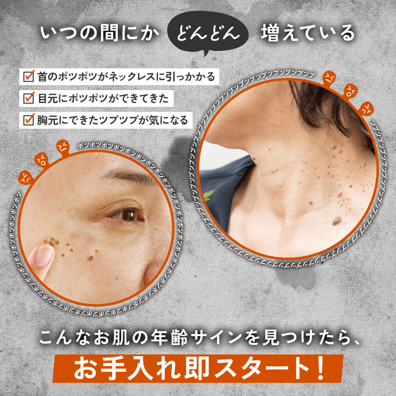 ハトムギエキス配合 イボ取りクリーム【日本製】薬用 イポツルン習慣美容液 老人性イボ 角質粒 シミ はとむぎ 杏仁 肌荒れ クリーム 首 目元 胸元 デコルテ ぽつぽつ ブツブツ ぶつぶつ 目の周り 首のポツポツ