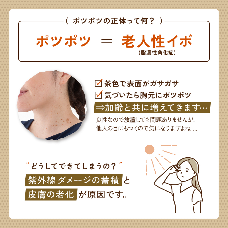ハトムギエキス配合 イボ取りクリーム【日本製】薬用 イポツルン習慣美容液 老人性イボ 角質粒 シミ はとむぎ 杏仁 肌荒れ クリーム 首 目元 胸元 デコルテ ぽつぽつ ブツブツ ぶつぶつ 目の周り 首のポツポツ