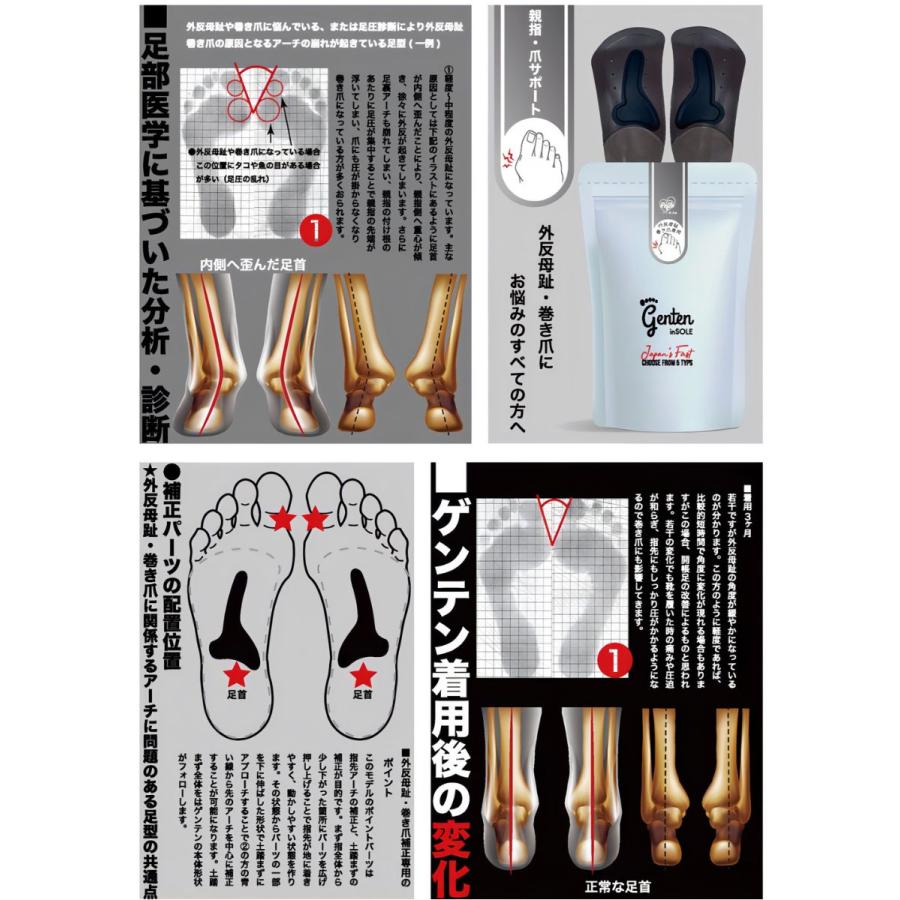 インソール 姿勢矯正 ゲンテン genten 5色 中敷き 足裏 姿勢改善 O脚