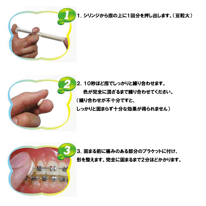 GISHY GOO ギシグー ホワイト 5ml × 5本 歯科専売 矯正 ブラケット ゆうパケット送料無料 :gishygoo05:エルアイビー  LIBヤフー店 - 通販 - Yahoo!ショッピング