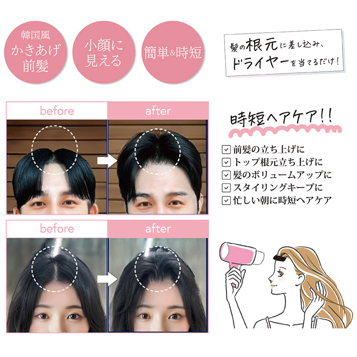 毛根クリップ L 根元立ち上げクリップ 前髪 （ ヘアクリップ カーラー