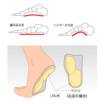 疲労対策 アーチウェッジヒールタイプ 衝撃対策ソール ブラウン Lサイズ 61089 61091