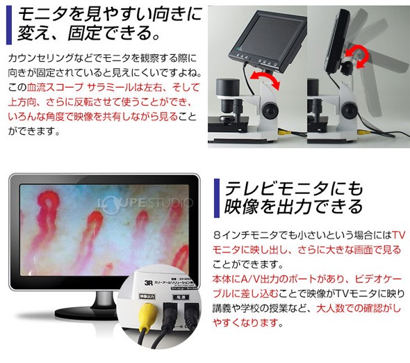 顕微鏡 血流スコープ サラミール 血管 検査 毛細血管 無採血 血流計測