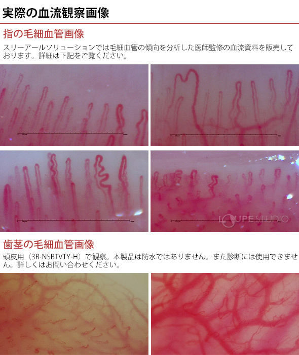 実際の血流観察画像 