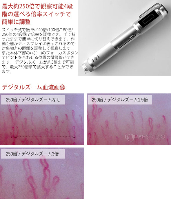 血流以外にも頭皮や肌を観察できる 