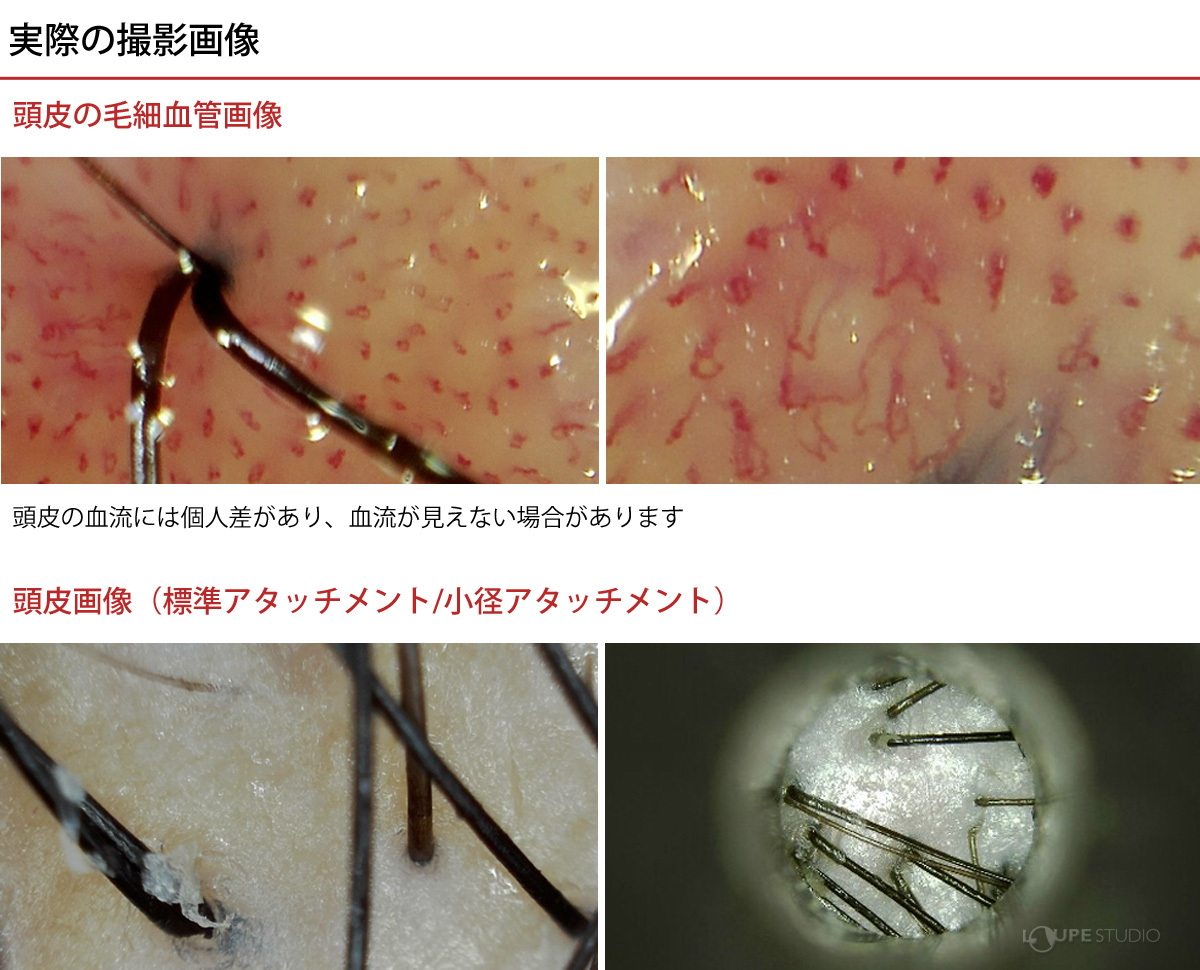 実際の撮影画像 