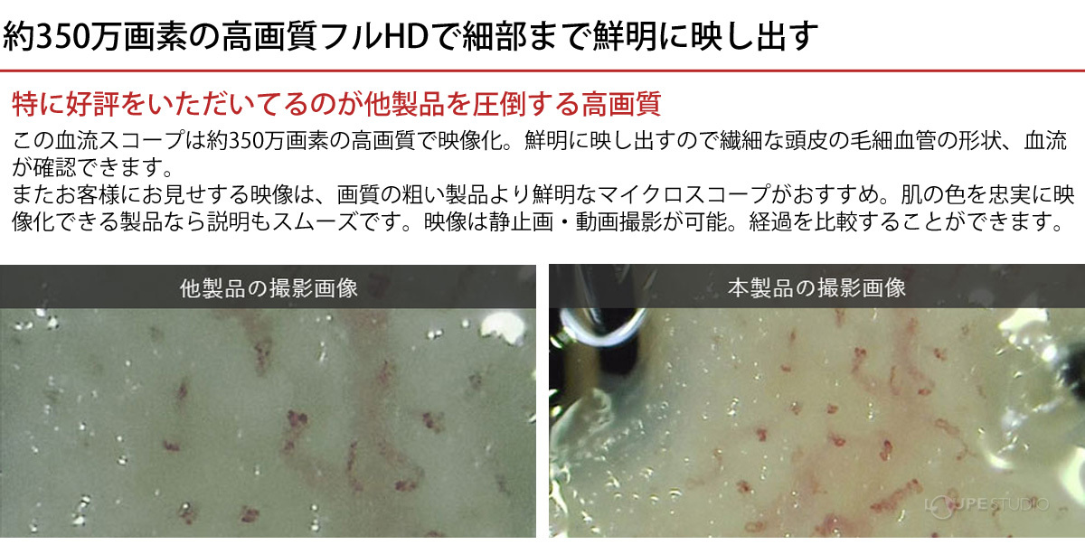 約350万画素の高画質フルHDで細部まで鮮明に映し出す 