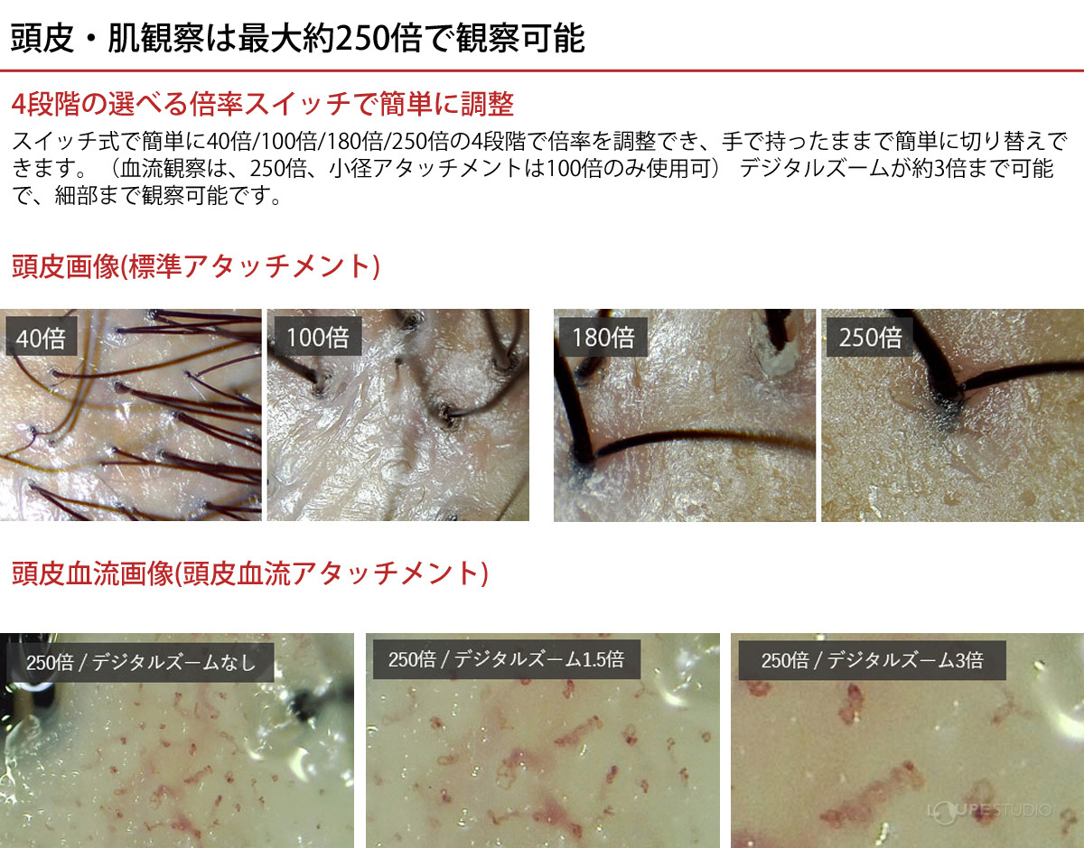 顕微鏡 血流スコープ 頭皮 肌 マイクロスコープ 頭皮血流 顕微鏡 血流スコープ 頭皮 肌 マイクロスコープ 頭皮血流